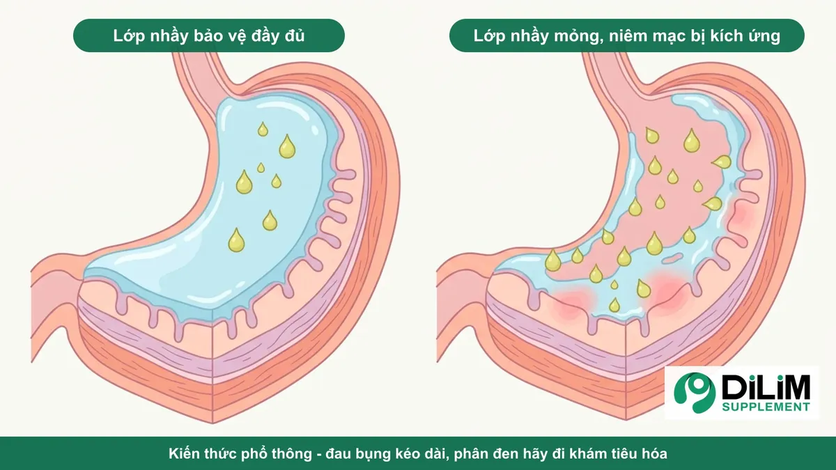 Minh họa kiến thức phổ thông: lớp nhầy bảo vệ niêm mạc dạ dày đầy đủ và lớp nhầy mỏng